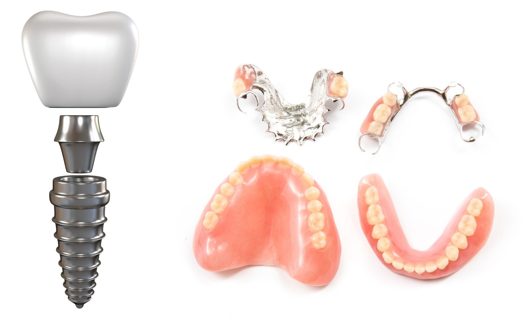 Main differences between a prosthesis and a dental implant Turkey, Istanbul
