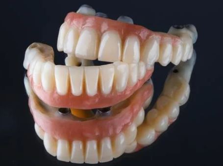 how-much-does-it-cost-for-full-set-of-teeth-implants-in-turkey