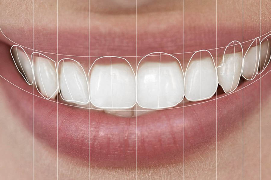 istanbul dental treatment