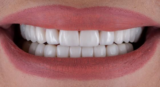 What should be done before & after zirconia crown procedure? in Turkey, Istanbul