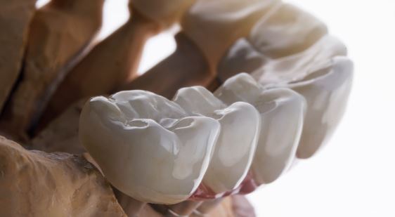 How to take care of your zirconia crown? in Turkey, Istanbul